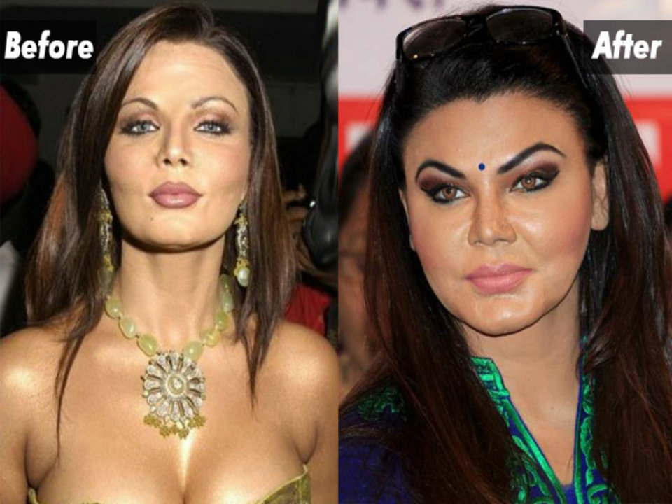 Rakhi Sawant